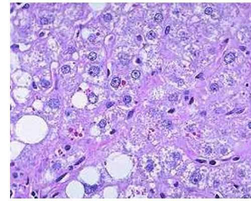 广州辅助生殖技术医院排名及费用明细