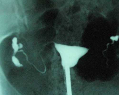 2026北京试管助孕条件,北京试管婴儿流程去十月幸孕助孕_有便宜代怀