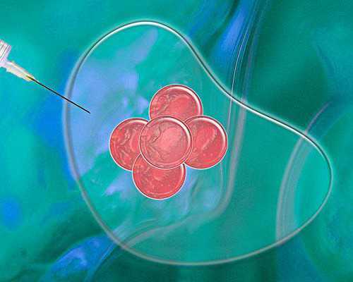 长春第三代试管助孕：选择哪一代技术实现生育愿望