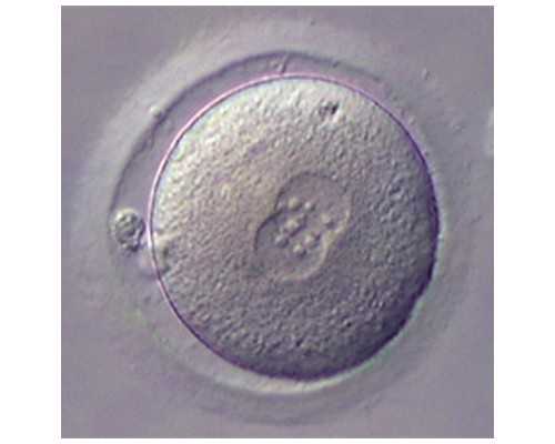 深入解析铁蛋白与健康：了解异常指标的可能原因