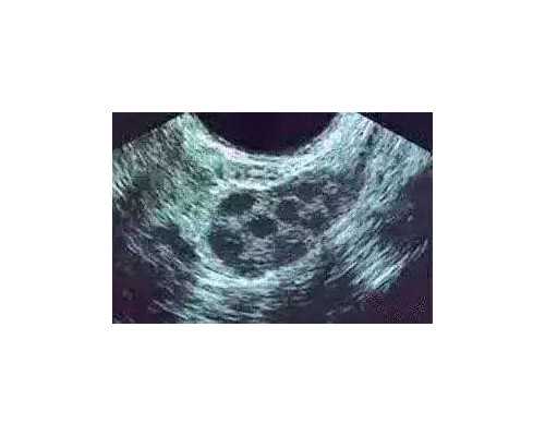 上海三代试管助孕成功率介绍?,上海第三代试管婴儿当十月幸孕助孕