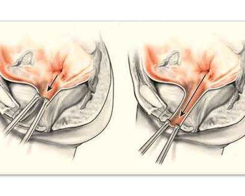 长春试管助孕：高龄女性备孕指南与助孕机构信息