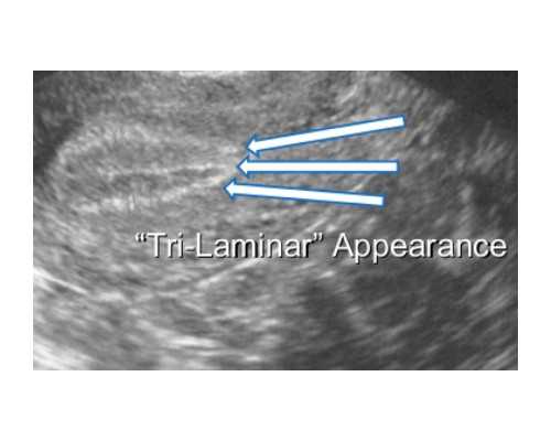 长春单身代怀好处|长春三代试管婴儿费用准多少